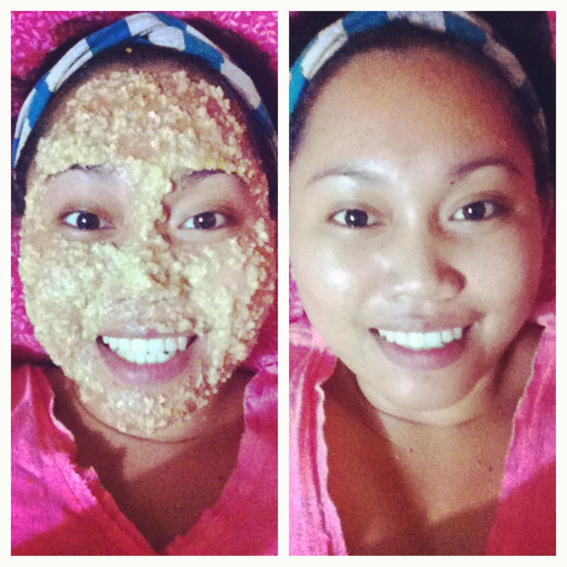Beauty Thing easy acne mask diy Remedy  for face A Breakouts Oatmeal: of